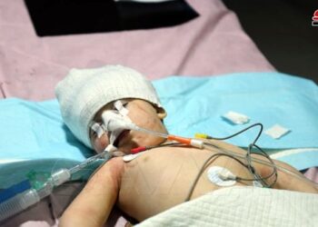 استشهاد مدنيين اثنين وإصابة آخرين بينهم أطفال في حلب