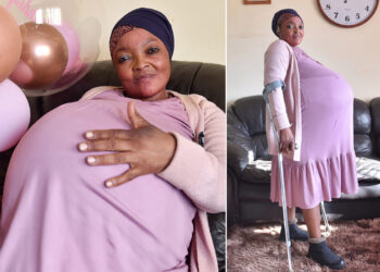 امرأة في جنوب إفريقيا تلد 10 توائم