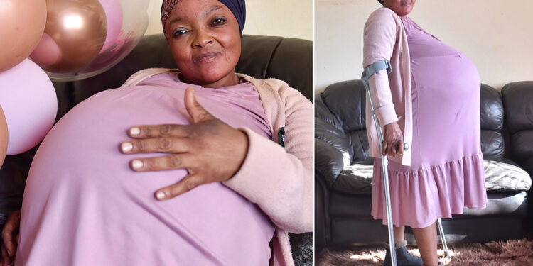 امرأة في جنوب إفريقيا تلد 10 توائم