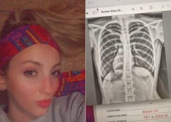 فتاة أمريكية تكتشف أن قلبها في مكان غير مكانه