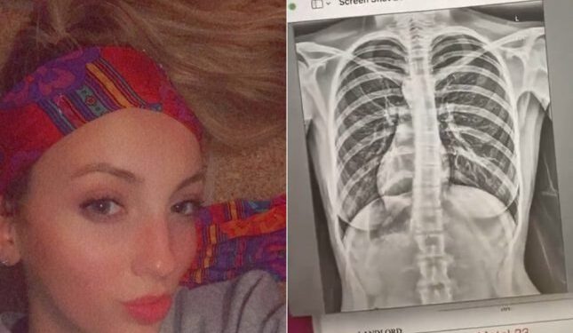 فتاة أمريكية تكتشف أن قلبها في مكان غير مكانه