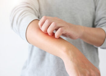 عارض جديد يدل على الإصابة بأوميكرون..