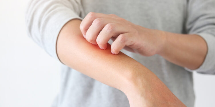 عارض جديد يدل على الإصابة بأوميكرون..