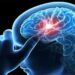ما تأثير كورونا على المخ والذاكرة؟