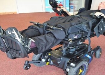 وفاة العالِم البريطاني الذي تحول إلى “أول سايبورغ بالكامل” في العالم