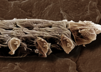 وجهك مغطى بالآلاف من كائنات “قد لا تكون لطيفة دائما”!