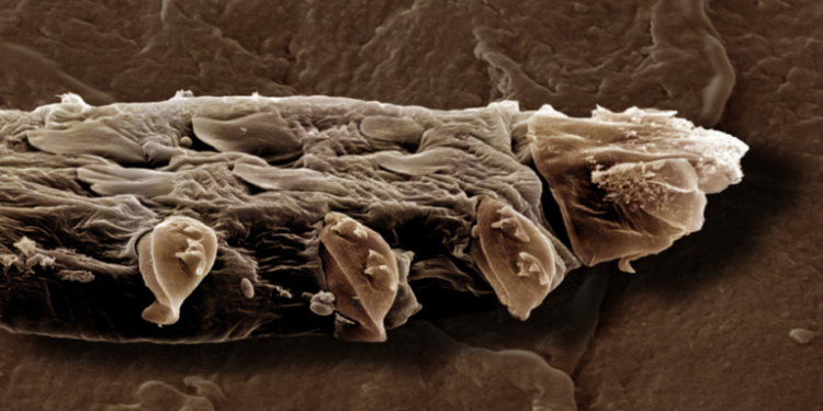 وجهك مغطى بالآلاف من كائنات “قد لا تكون لطيفة دائما”!